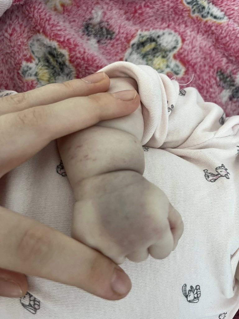 Spitalul Județean Buzău, din nou, ținta reclamațiilor. Mama unui bebeluș de două luni face acuzații grave:” Fetița mea a fost învinețită de la manevre, a plâns..”